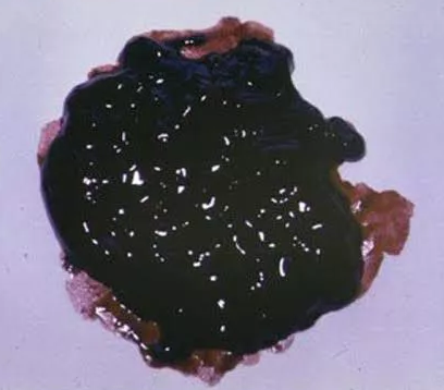 black_coloured_motion-melena