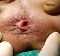 mass_coming_out_of_anus (3)