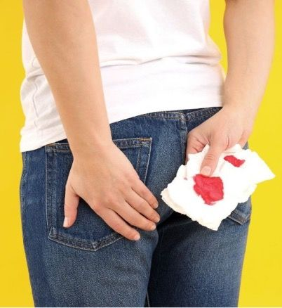 passing-blood-in-motion-rectal-bleeding